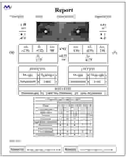 Авторефрактометр V-100 (Китай) Shanghai MediWorks Precision Instruments Со., Ltd. ("Шанхай МедиВоркс Пресижн Инструментс Ко., Лтд.")