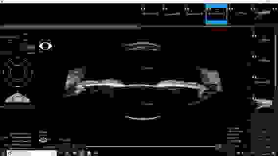 Офтальмологическая ультразвуковая система VuMax HD с принадлежностями, Sonomed Inc., США// VuMax-HD (A,B20,UBM)