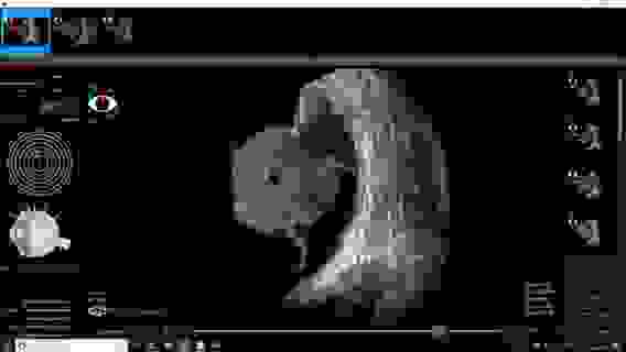 Офтальмологическая ультразвуковая система VuMax HD с принадлежностями, Sonomed Inc., США// VuMax-HD (A,B20,UBM)